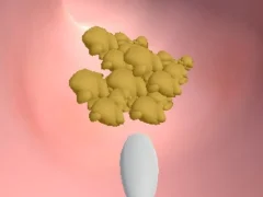 Oyunu Earwax Clinic çevrimiçi