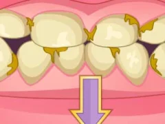Oyunu Bad Teeth Makeover çevrimiçi