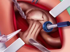 Oyunu Princess Hips Surgery çevrimiçi