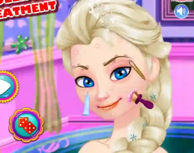 Oyunu Ice Queen Acne Treatment çevrimiçi